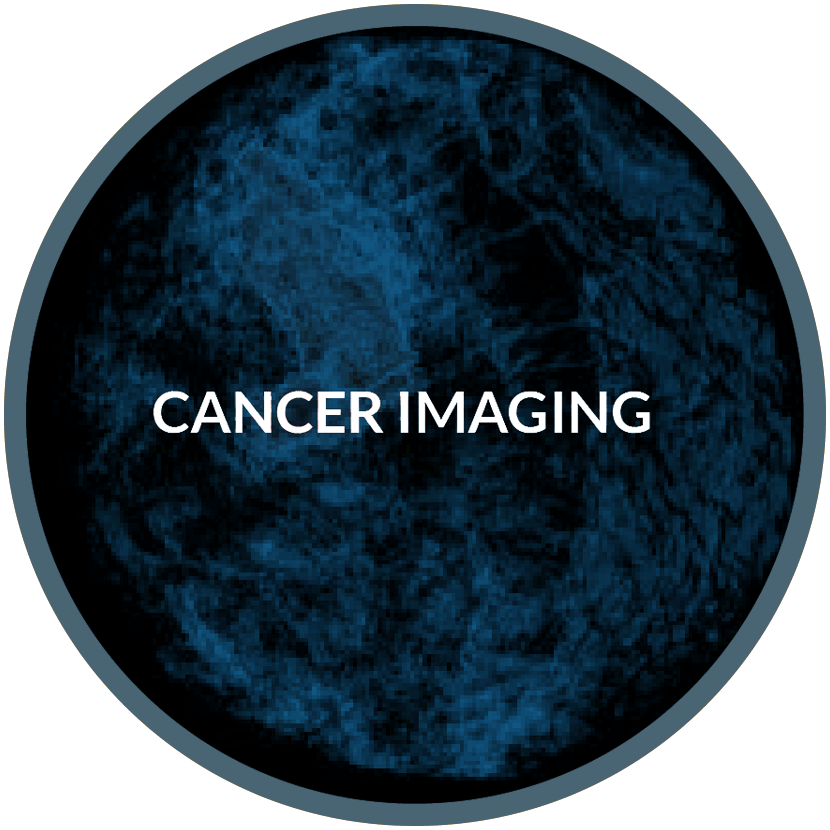 cancer-imaging-02