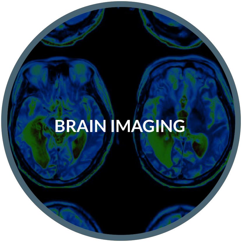 brain-imaging2