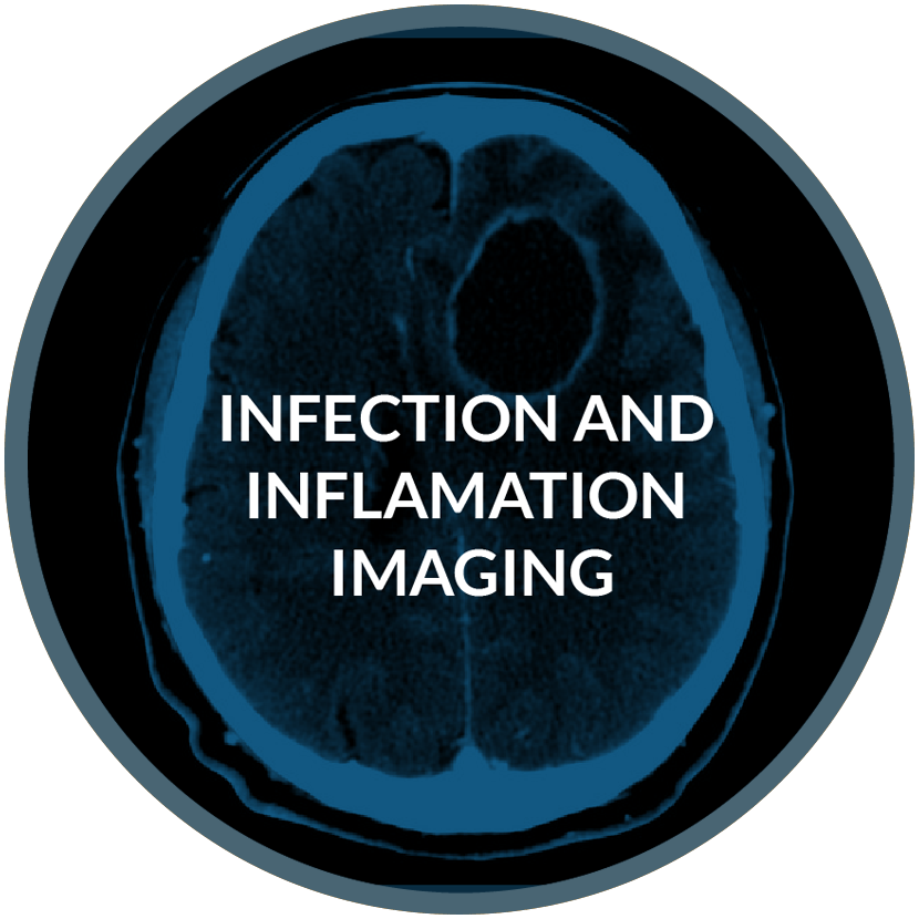 infection-and-inflamation-imaging2